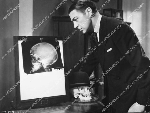 Clive Brook w x-ray of skull - 11011-021