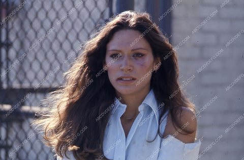 someone gave Pamela Hensley a shiner unknown production 35m-5164