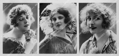 crp-13922 1920's news photo odd Paris contest "most Perfect Cupid Bow Shaped Mouth" Mlle Dorin, Adaline Ramee, Alice Pernet crp-13922